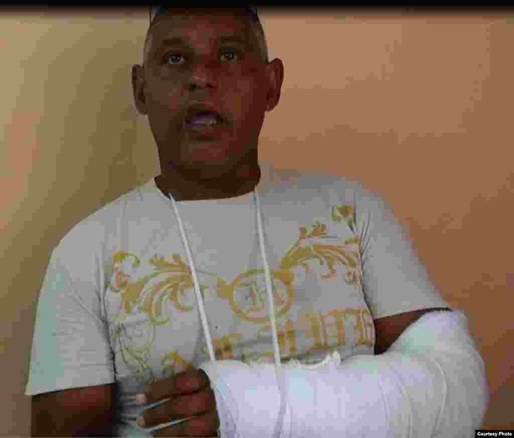 Hablemos Press divulga imagenes de activistas victimas de agresiones.