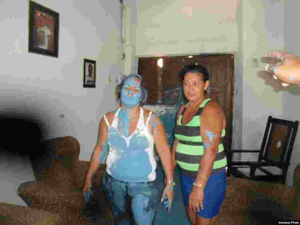 Hablemos Press divulga imagenes de activistas victimas de actos de repudio y agresiones